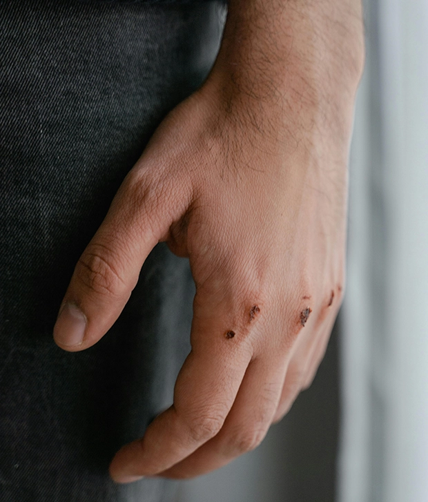 injuries after a slip and fall accident