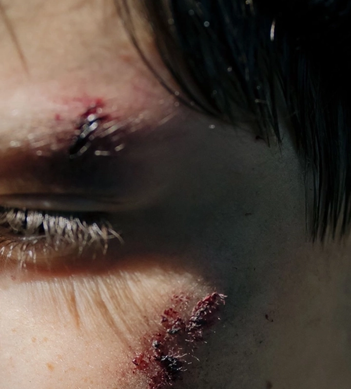 personal injury claim involves